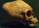 The story behind deformed ancient skulls The story behind deformed ancient skulls