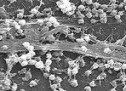 ÇFARË ËSHTË BIOFILMI? ÇFARË ËSHTË BIOFILMI?