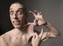 NJERIU ME LËKURËN MË ELASTIKE NË BOTË! (FOTO) NJERIU ME LËKURËN MË ELASTIKE NË BOTË! (FOTO)